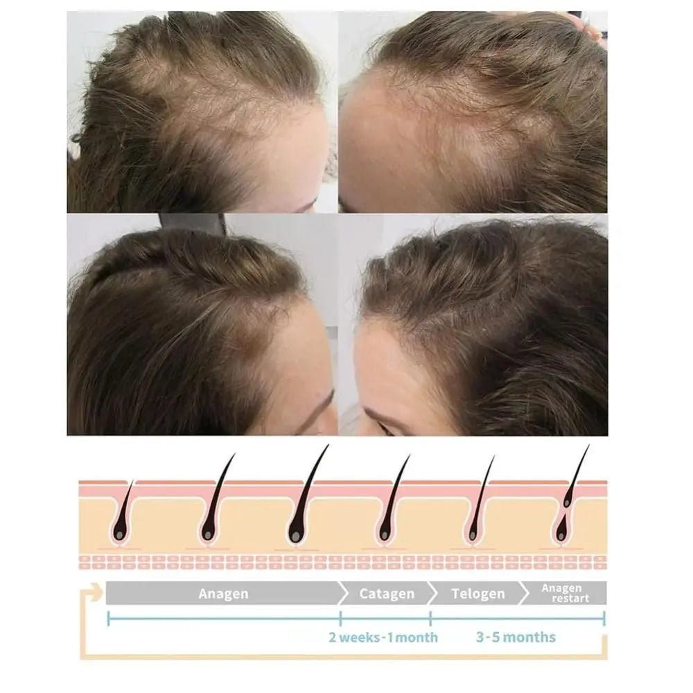 Vortex Comb Bundle for Hair Nourishment with High Frequency Settings - Hair Growth Wand and Facial Care Device
